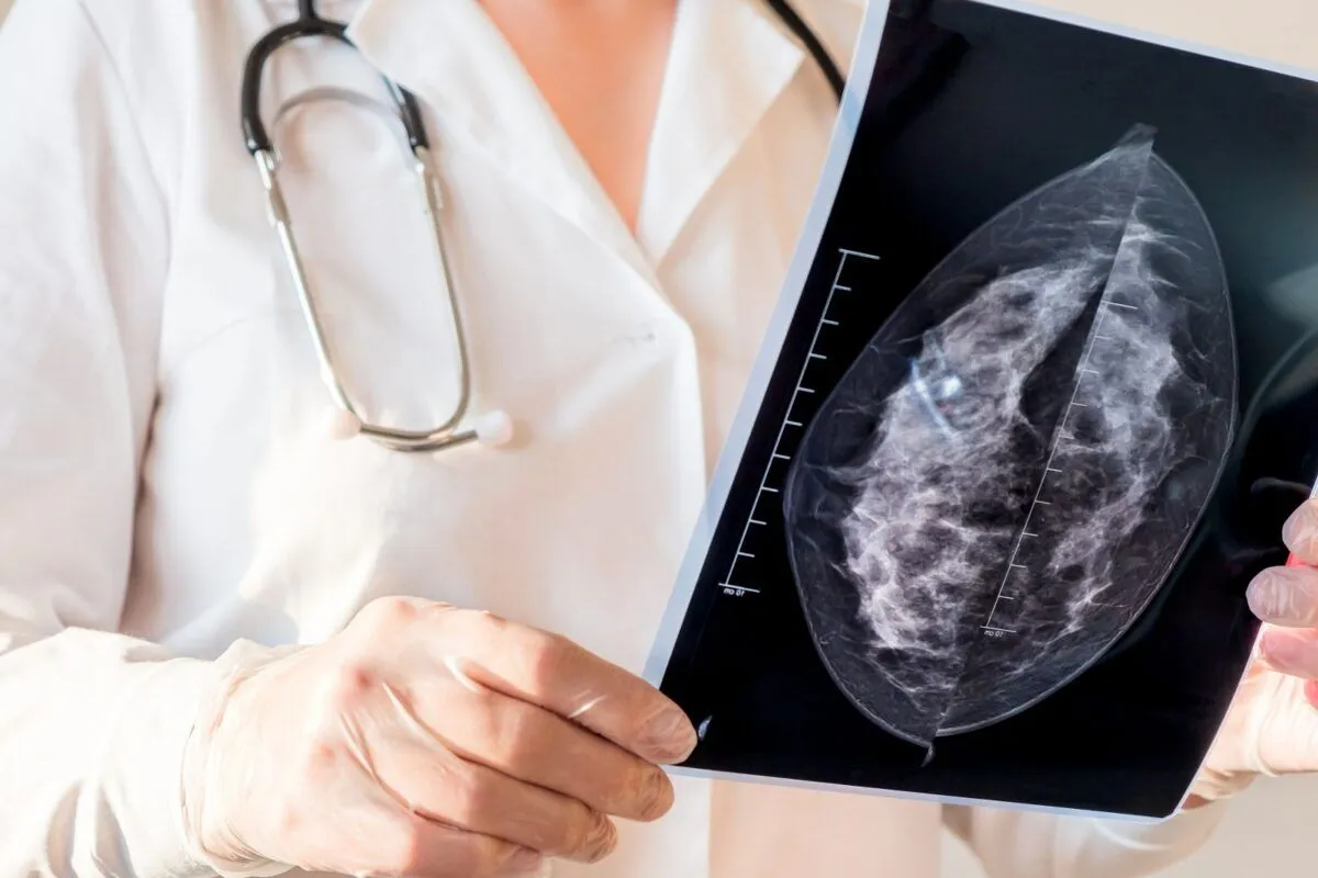 Estudio reveló tratamiento más efectivo para pacientes con cáncer de mama metastásico
