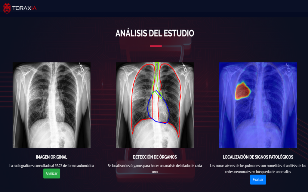El venezolano que creó una Inteligencia Artificial capaz de detectar riesgo de neumonía