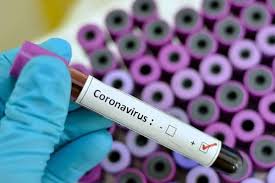 Qué medidas se han aplicado en Latinoamérica para combatir el coronavirus