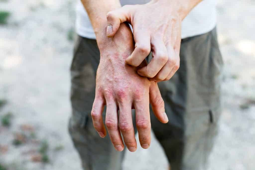 ¿Cómo evitar dañar las manos por el uso excesivo de jabón?