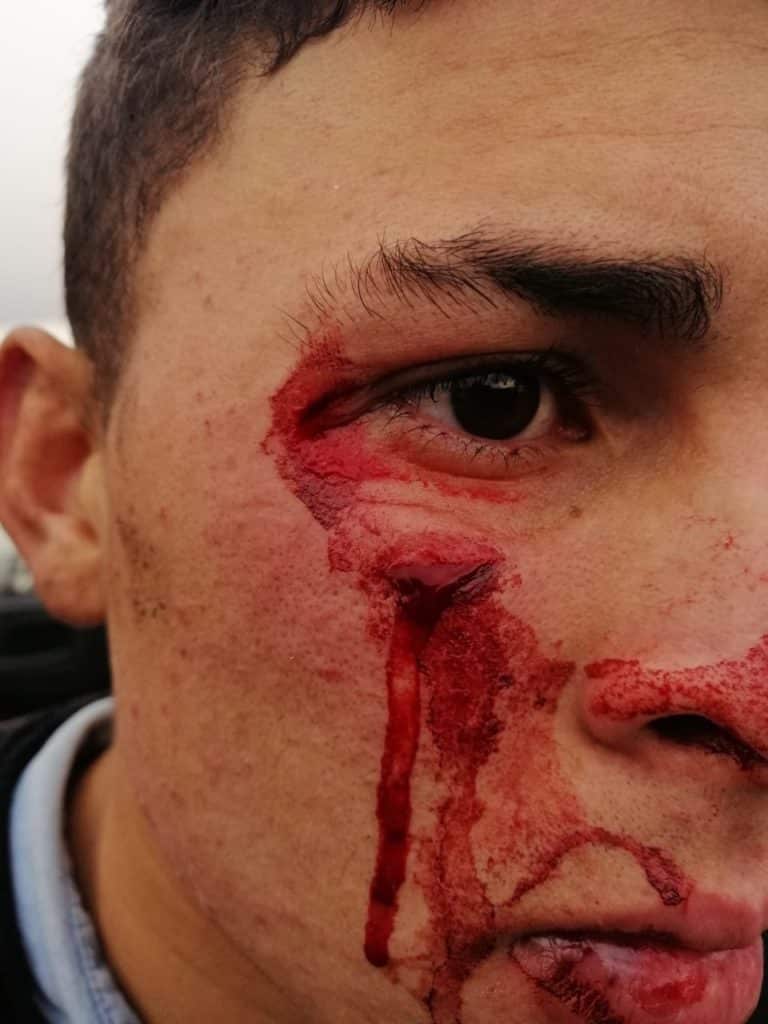 Xenofobia e impunidad, el drama de un venezolano en Ecuador