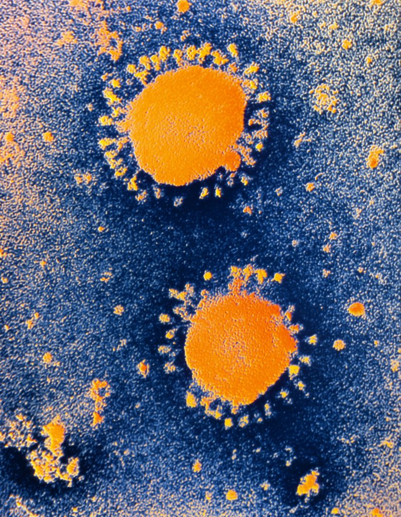 Imagen Dos coronavirus que causan frío común. Crédito