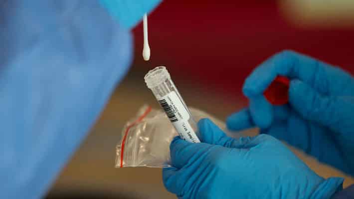 “Las pruebas PCR se están analizando con hasta ocho días de retraso”