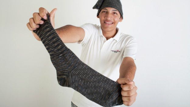 Jeison Rodríguez: el venezolano con los pies más grandes del mundo clama por ayuda para costear su tratamiento