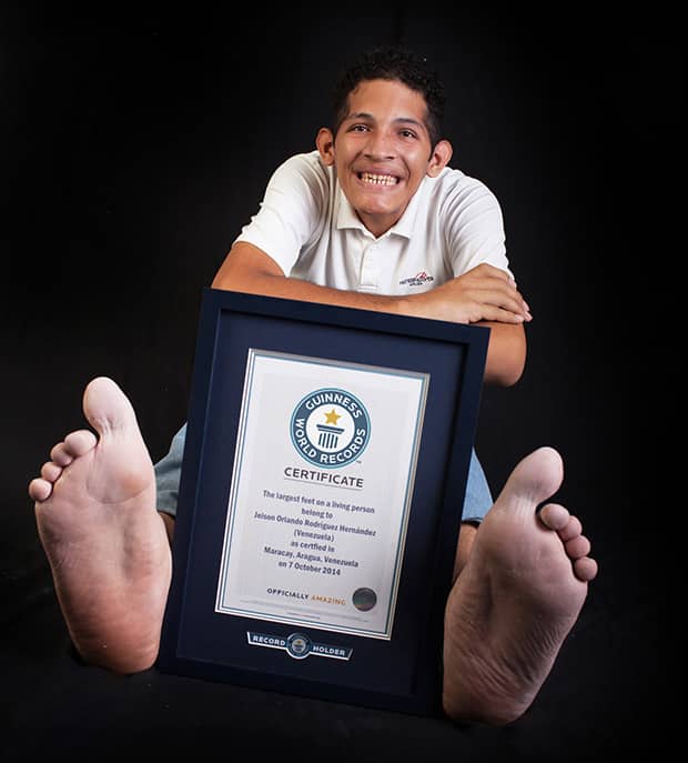 El venezolano con los pies más grandes del mundo clama por ayuda para costear su tratamiento