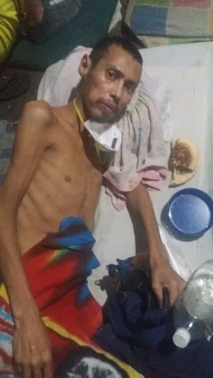 Enfermedades y violaciones de DD HH: el cruel rostro de los centros de detención en Venezuela