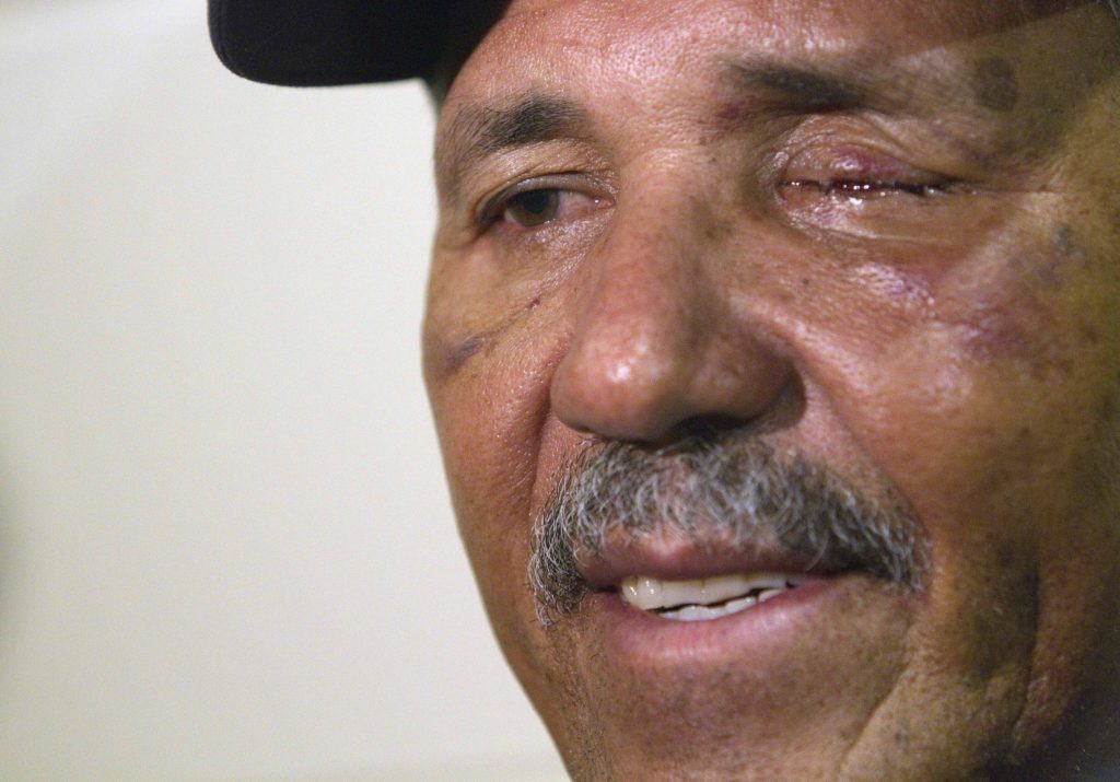 Luis Salazar: diez años de un pelotazo que le hizo perder un ojo