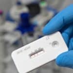 ¿Es recomendable hacerse pruebas de anticuerpos luego de vacunarse contra el covid-19?