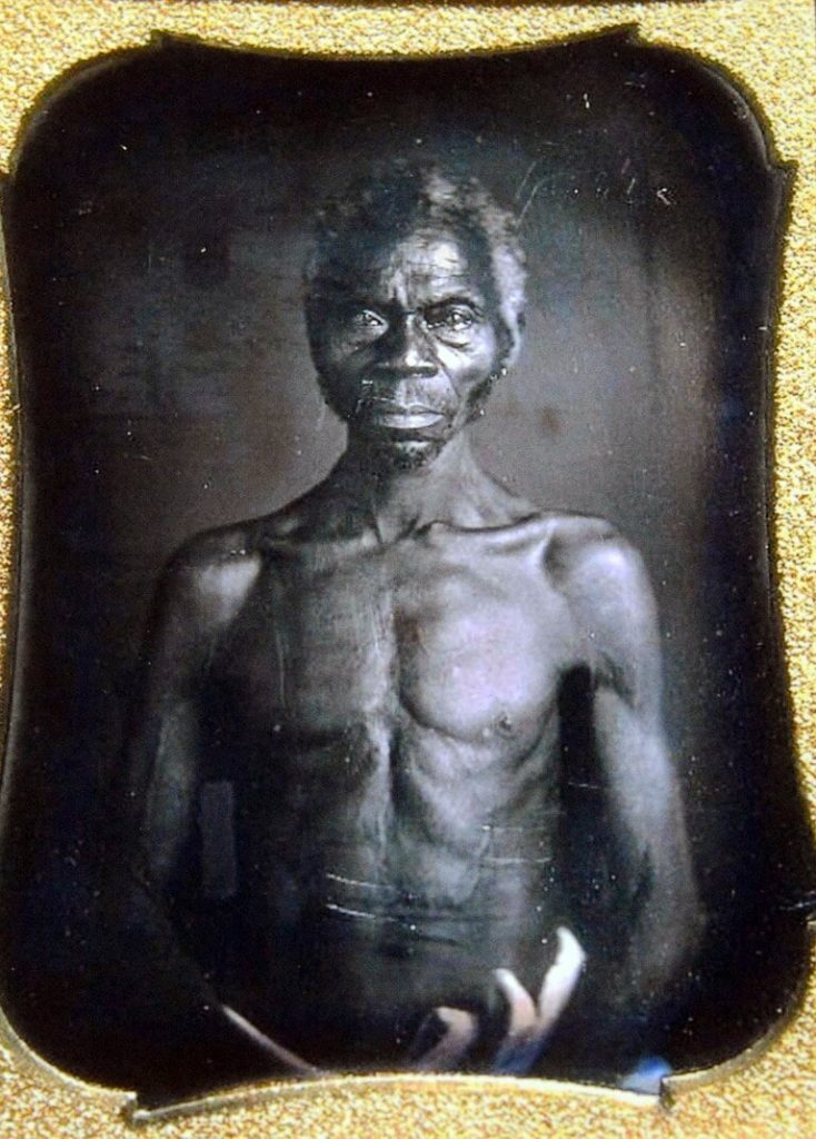 Un científico racista de Harvard tomó fotografías de personas esclavizadas en 1850. Una supuesta descendiente está demandando