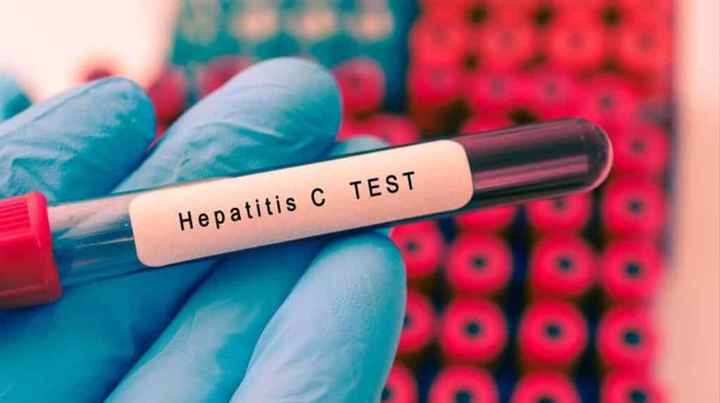 Hepatitis aguda infantil en aumento: la OMS reportó casi 170 casos en 11 países