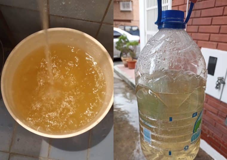 Agua de mala calidad en Caracas: cuáles son los riesgos para la salud si se usa en el hogar 