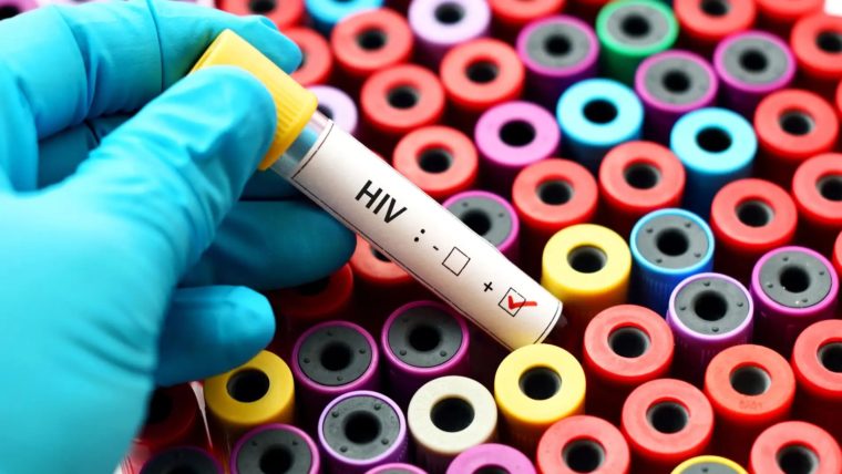 ¿Por qué el VIH se considera menos letal que hace 40 años?