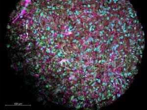 Científicos anunciaron un nuevo campo de inteligencia organoide: ¿qué es y cuáles avances representa?
