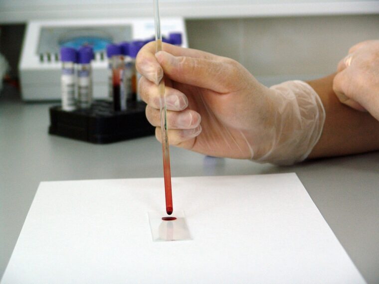 Exámenes de sangre intravenosos podrían ser sustituidos por análisis tomados de la yema del dedo