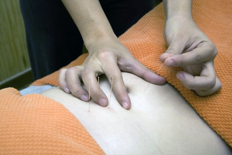 La combinación de acupuntura y fármacos podría aliviar las náuseas y vómitos durante el embarazo