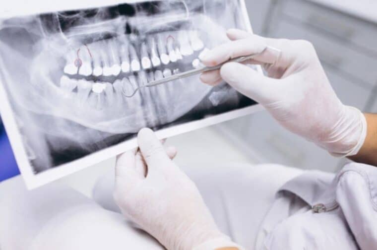 Investigadores desarrollan un fármaco para regenerar dientes de manera natural