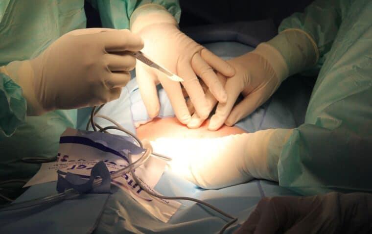 Cirujanos logran que un riñón de cerdo modificado funcione desde hace un mes en un cuerpo humano
