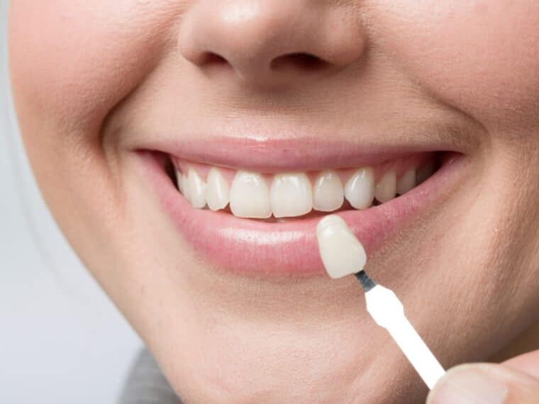 Tratamiento de ortodoncia y diseño de sonrisa: ¿en qué se diferencian y cuánto cuestan?