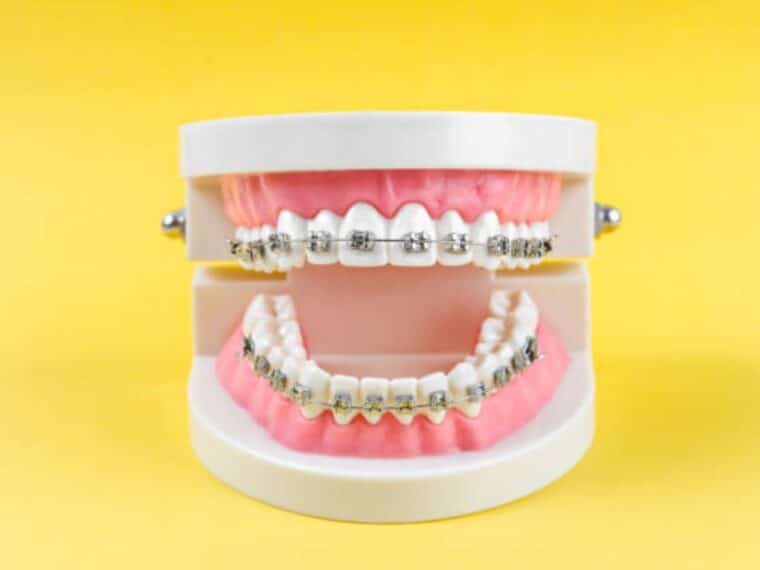 Tratamiento de ortodoncia y diseño de sonrisa: ¿en qué se diferencian y cuánto cuestan?