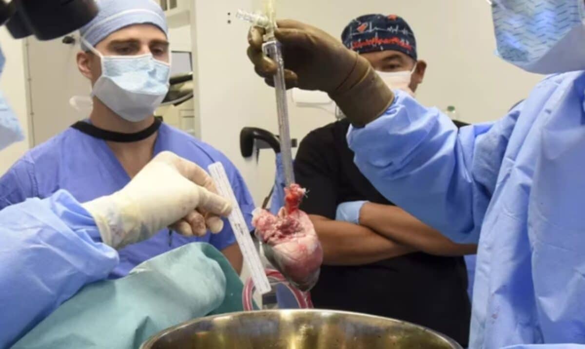 Murió el segundo paciente en recibir un trasplante de corazón de un cerdo