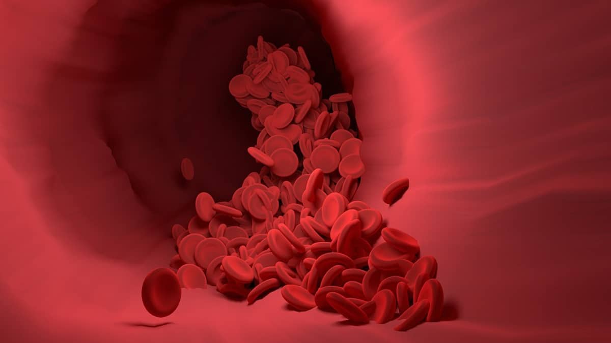 Un estudio reveló la relación de niveles de colesterol alto y muerte prematura en jóvenes