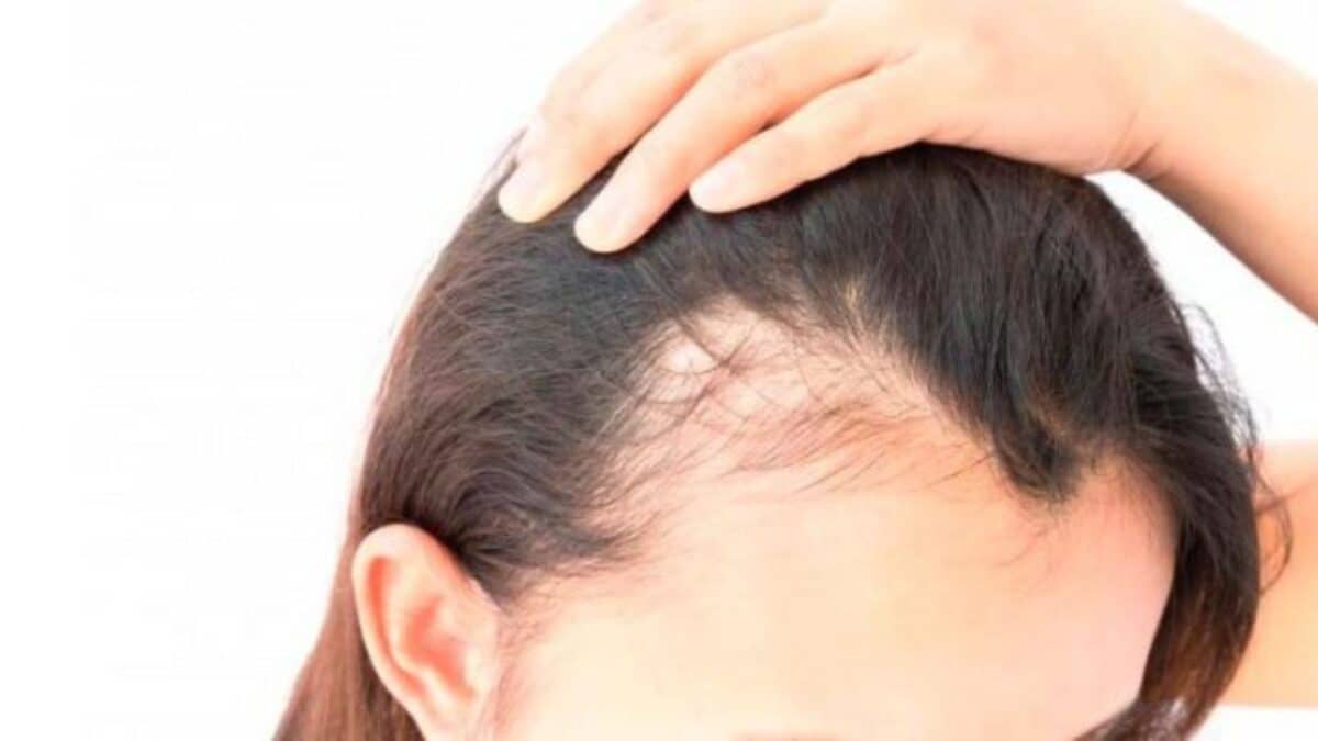 Las causas de la caída del cabello en mujeres y sus tratamientos 