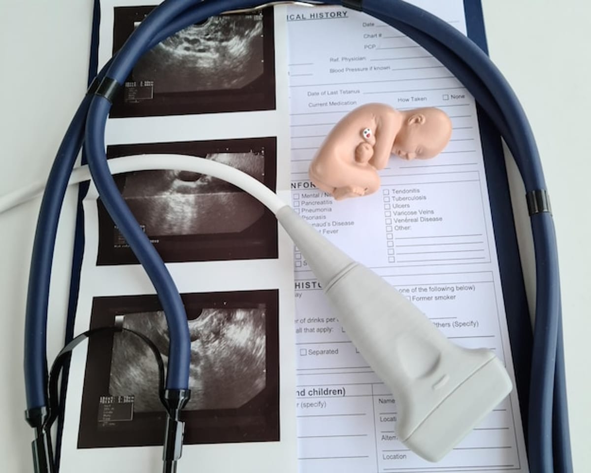 ¿Cuáles son las pruebas durante el embarazo para detectar el síndrome de Down en el feto?