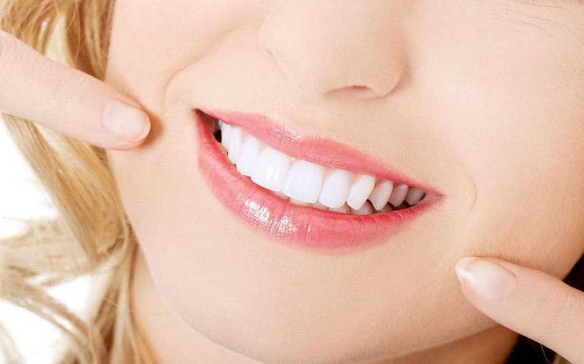 Blancorexia: ventajas y riesgos del blanqueamiento dental