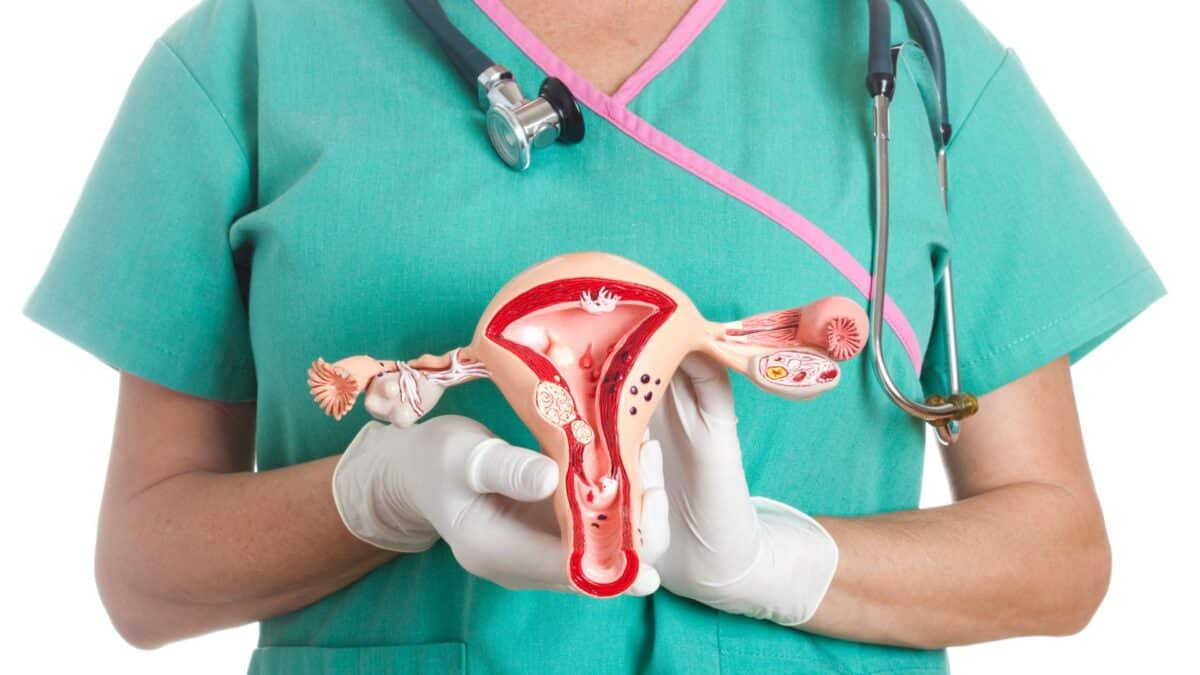 Cáncer de ovarios: el 80 % de los casos son diagnosticados en etapa avanzada