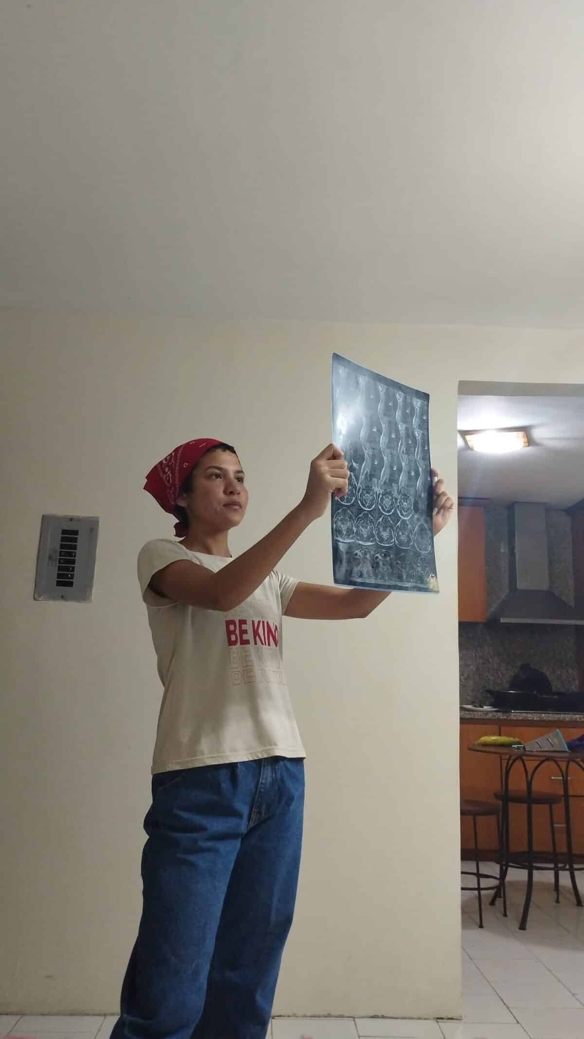 La ausencia de medicinas para la esclerosis múltiple pone en riesgo a cerca de 1.500 personas en Venezuela 