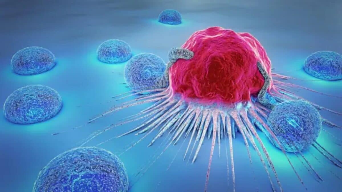 Study finds nearly half of cancer deaths in the US might have been prevented