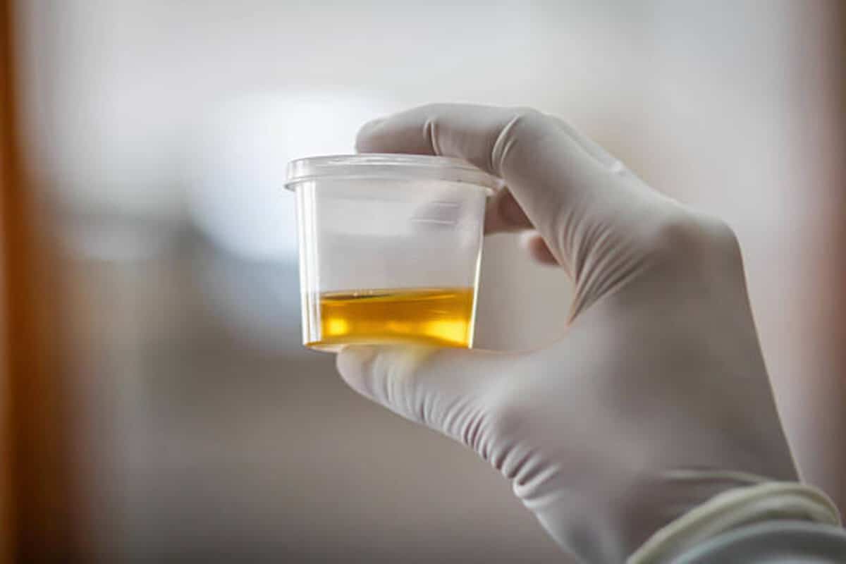 Desarrollaron una prueba de orina para detectar el cáncer de cuello uterino