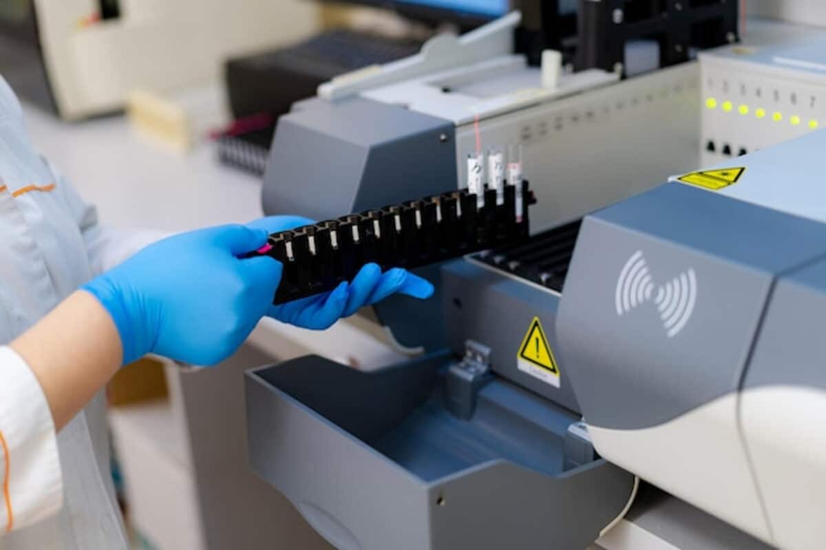 Desarrollaron sensores para detectar cáncer de pulmón a través del aliento