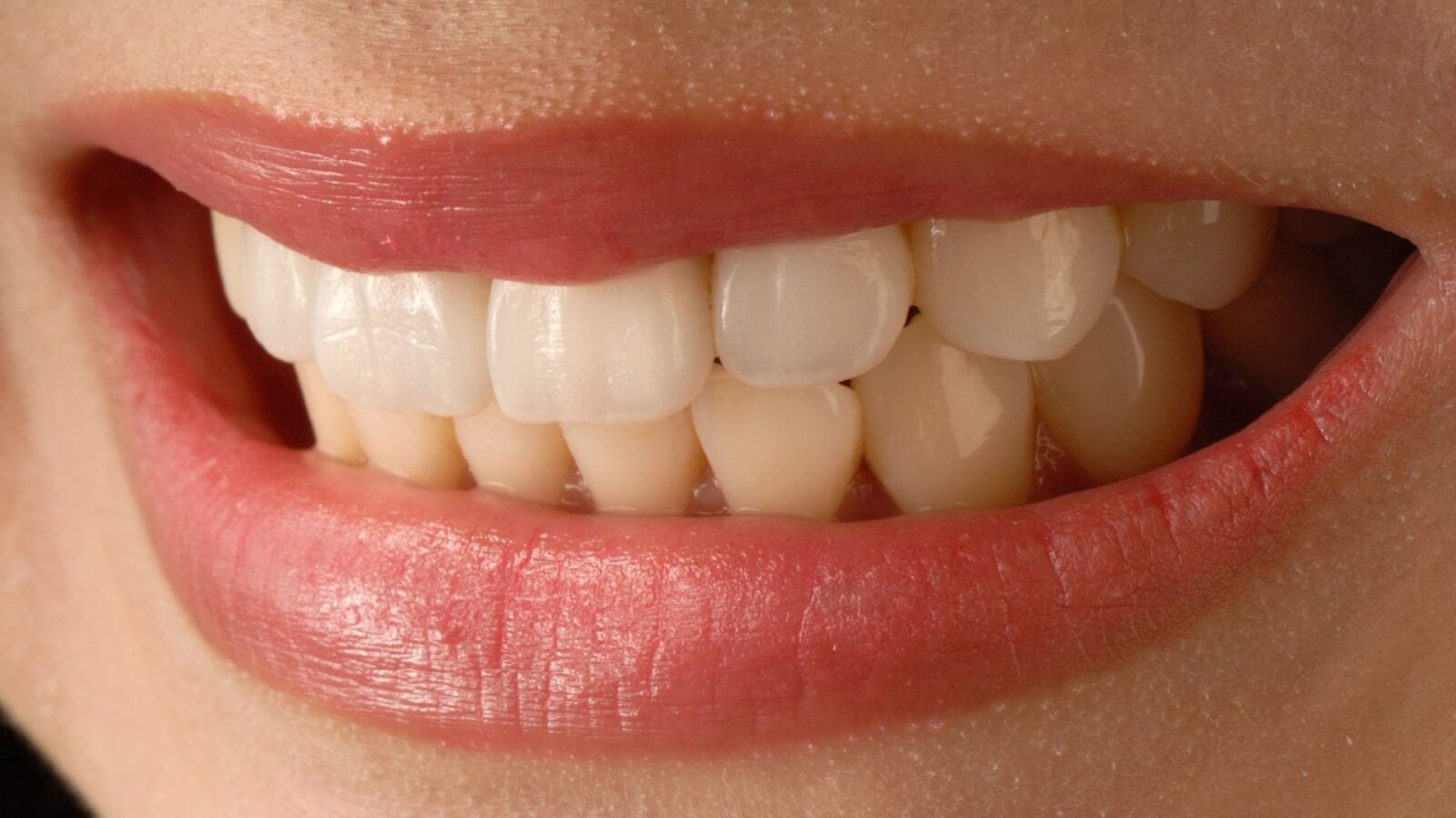 Las bebidas y alimentos que pueden manchar los dientes: ¿qué alternativas existen para evitarlo?