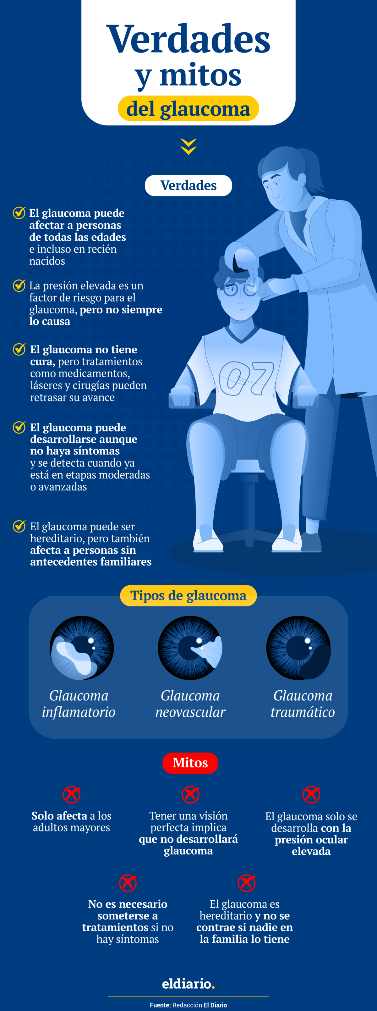 Glaucoma: las verdades y mitos sobre está enfermedad