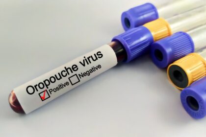 Confirmaron cinco casos del virus Oropouche en Venezuela: ¿cómo se contagia y cuáles son sus síntomas?