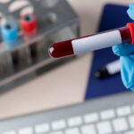 Síntomas y tratamiento de la hemofilia: ¿Cuál es la realidad de este trastorno en Venezuela?