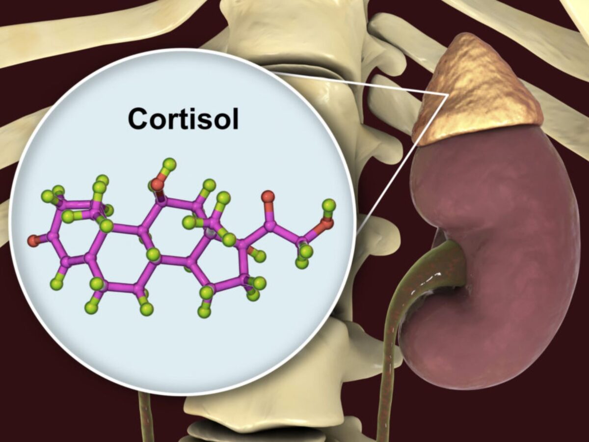 ¿Qué causa la alteración de cortisol y cuáles son sus síntomas?