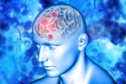 Crearon método con IA que predice si una persona podría sufrir un ACV