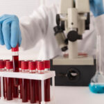 Desarrollaron sangre artificial que es compatible con todos los grupos sanguíneos