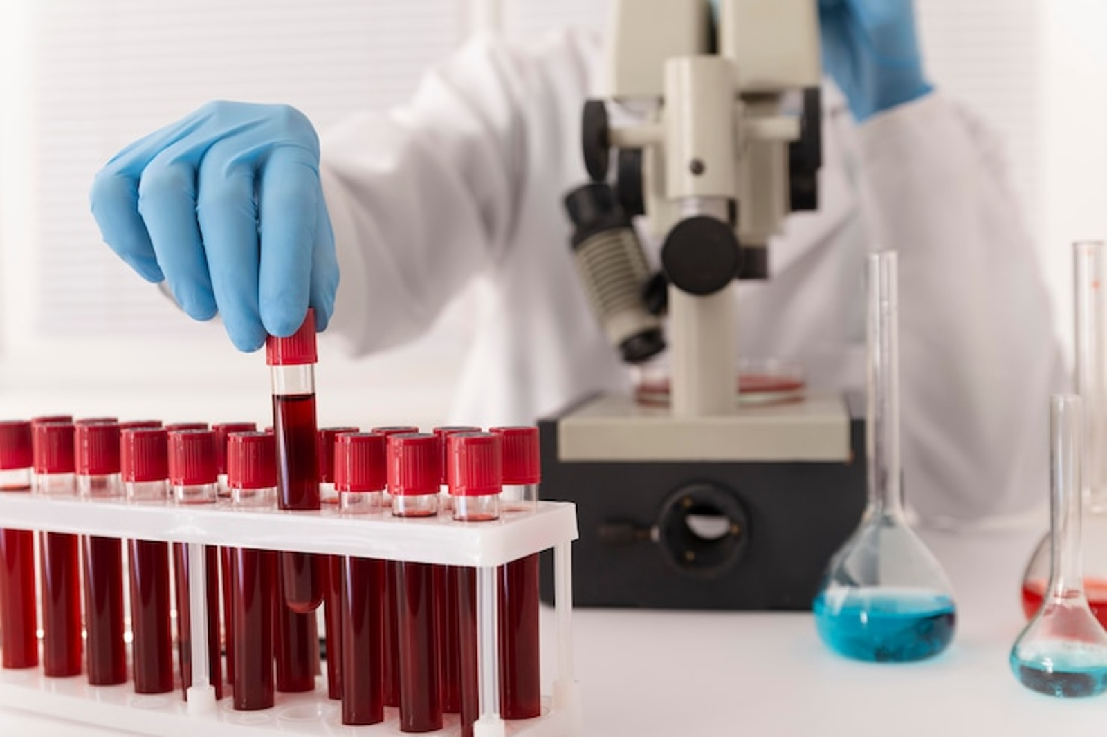Comprobaron la efectividad de un examen de sangre que permite detectar ...