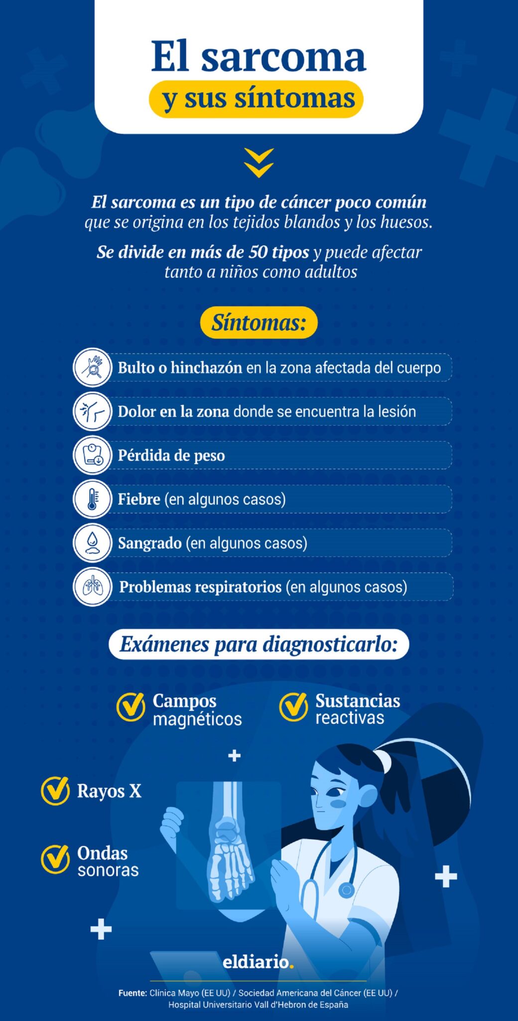 ¿Qué es el sarcoma y cómo se diagnostica este tipo de cáncer?
