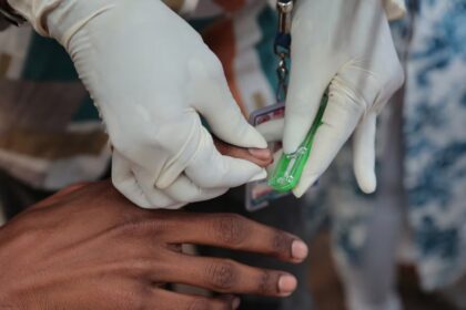 ONU alertó que cuatro millones de personas podrían morir de sida para 2030 por recortes de EEUU