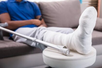 La fractura de tibia es la lesión más común en motorizados durante accidentes de tránsito 