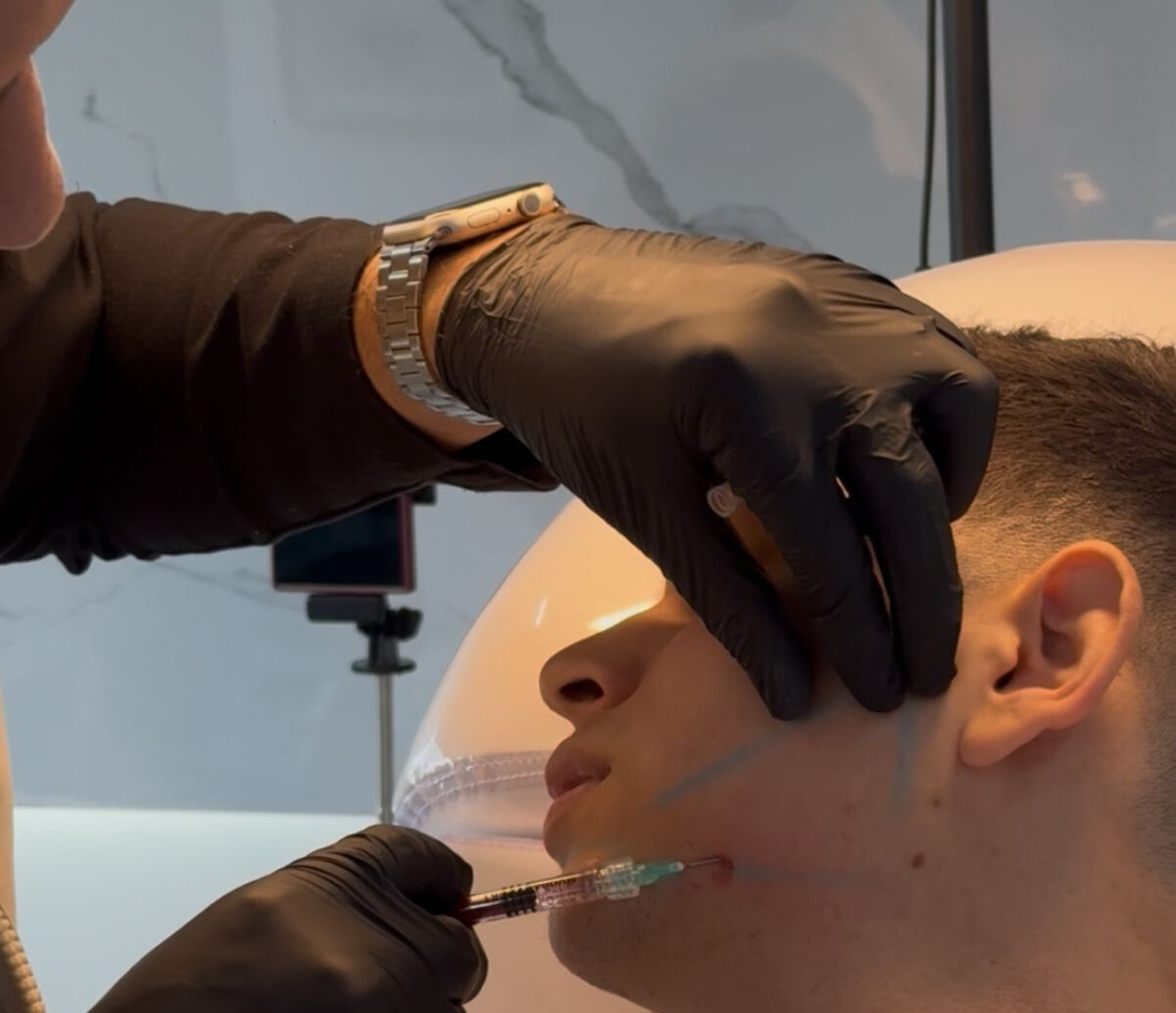 Procedimientos estéticos masculinos: cuáles son y qué riesgos implican