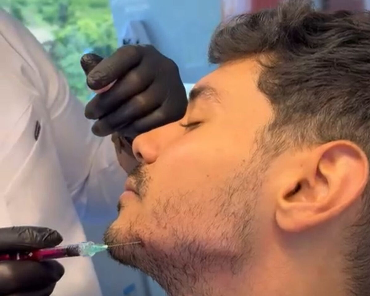Procedimientos estéticos masculinos: cuáles son y qué riesgos implican