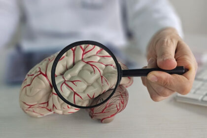 ¿Qué es un aneurisma cerebral y por qué se produce?