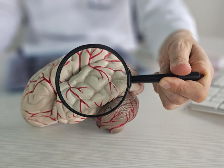¿Qué es un aneurisma cerebral y por qué se produce?