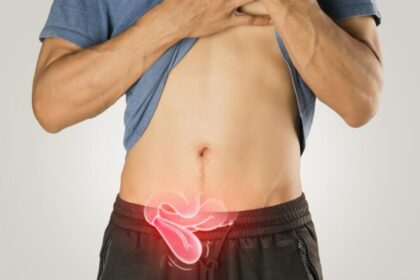 ¿Es posible hacer ejercicio si tienes una hernia?
