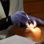 Un estudio encontró un vínculo entre la genética y la aparición de caries dentales 